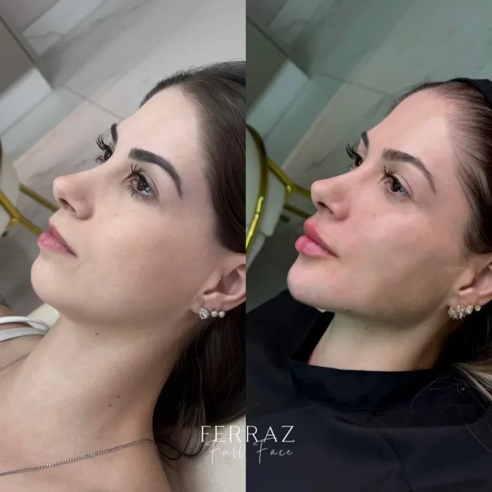 ezy_watermark_01_10_2024_20_57_41_1020