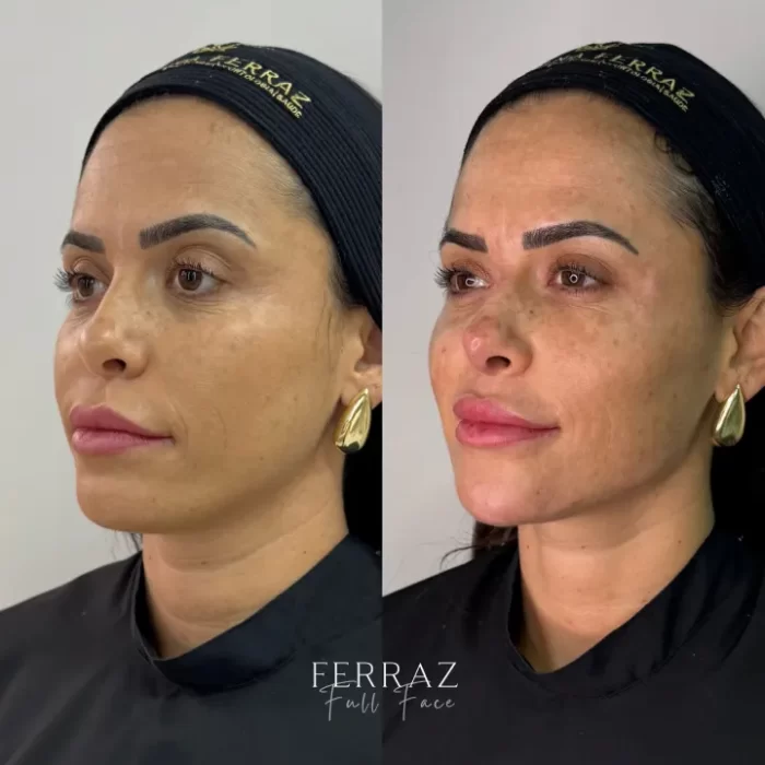 ezy_watermark_05_02_2025_18_24_43_7570