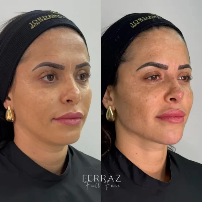 ezy_watermark_05_02_2025_18_39_52_3730