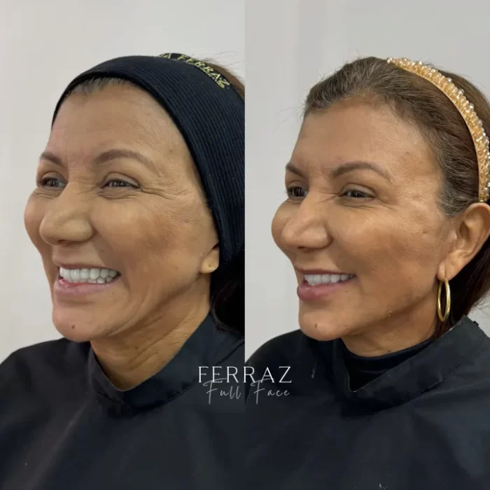 ezy_watermark_10_09_2025_15_42_34_1450