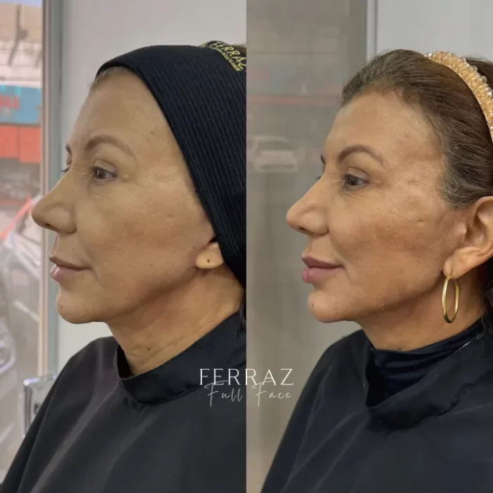 ezy_watermark_10_09_2025_15_42_37_4530