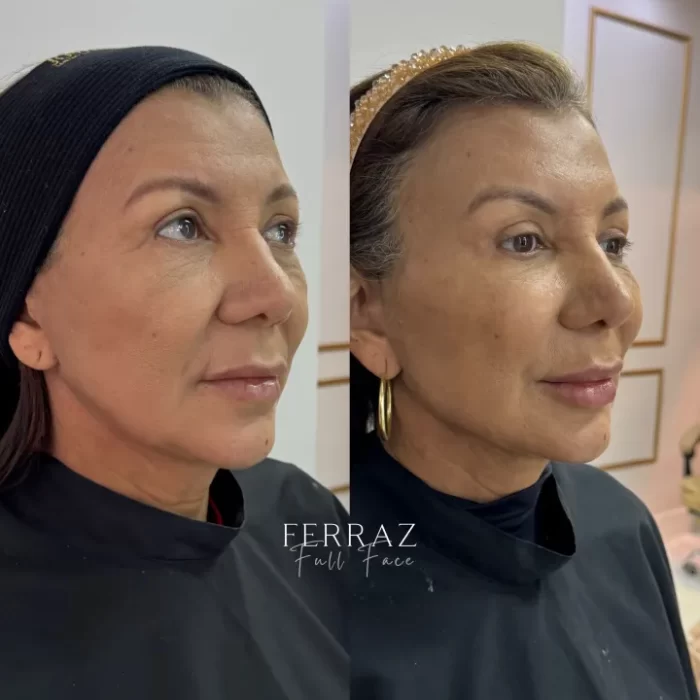 ezy_watermark_10_09_2025_15_42_38_8590