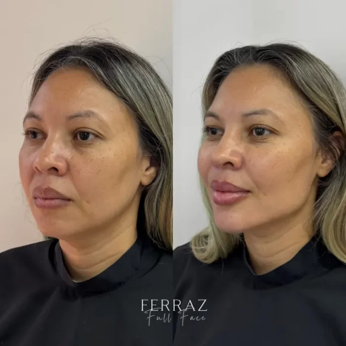 ezy_watermark_12_04_2025_13_01_55_3990