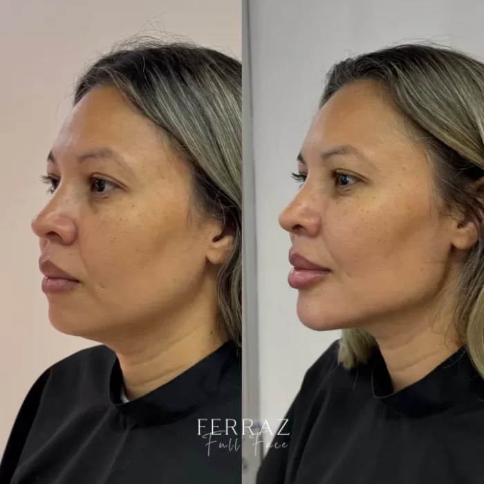 ezy_watermark_12_04_2025_13_01_55_7650