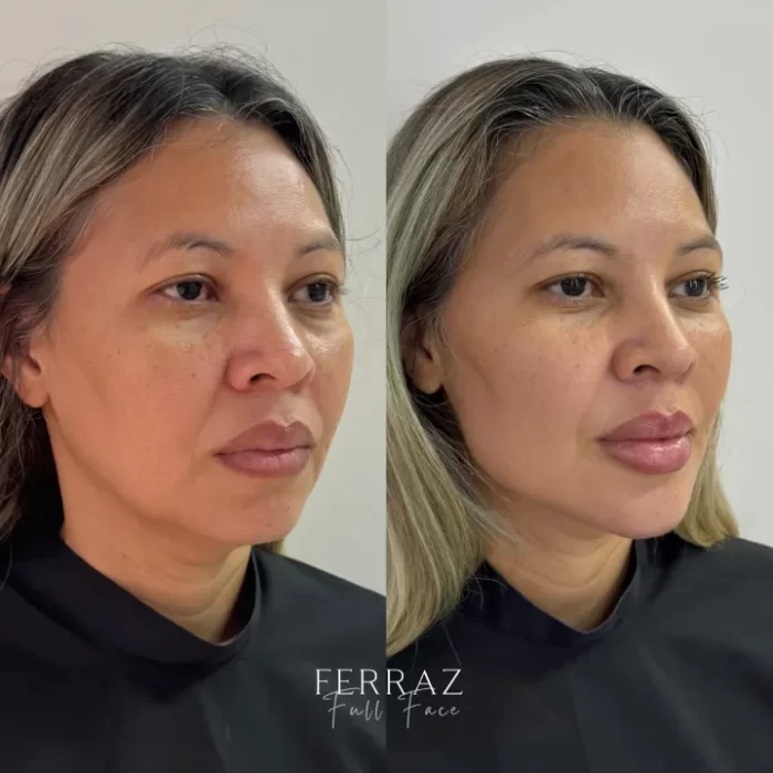 ezy_watermark_12_04_2025_13_01_56_5390