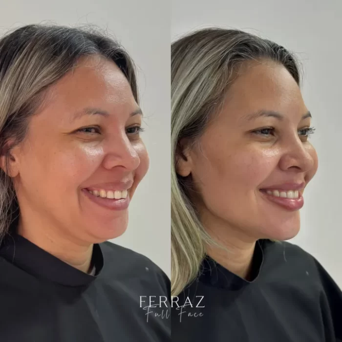 ezy_watermark_12_04_2025_13_01_58_0340