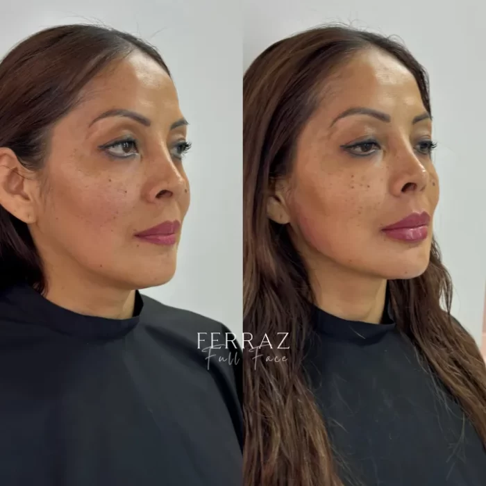 ezy_watermark_13_08_2025_12_43_49_2790