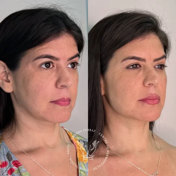 ezy_watermark_14_08_2023_12_45_21_4650