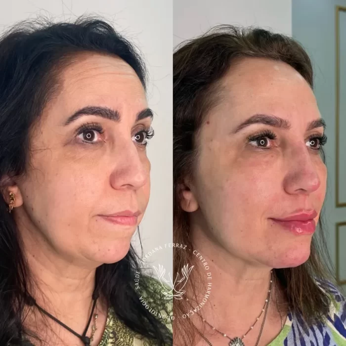 ezy_watermark_14_11_2023_14_35_27_2290