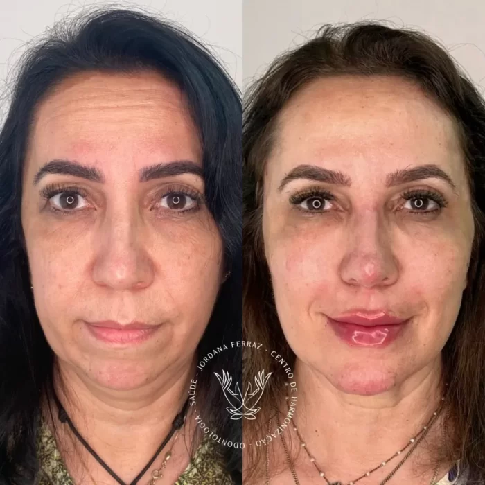 ezy_watermark_14_11_2023_14_35_28_1820