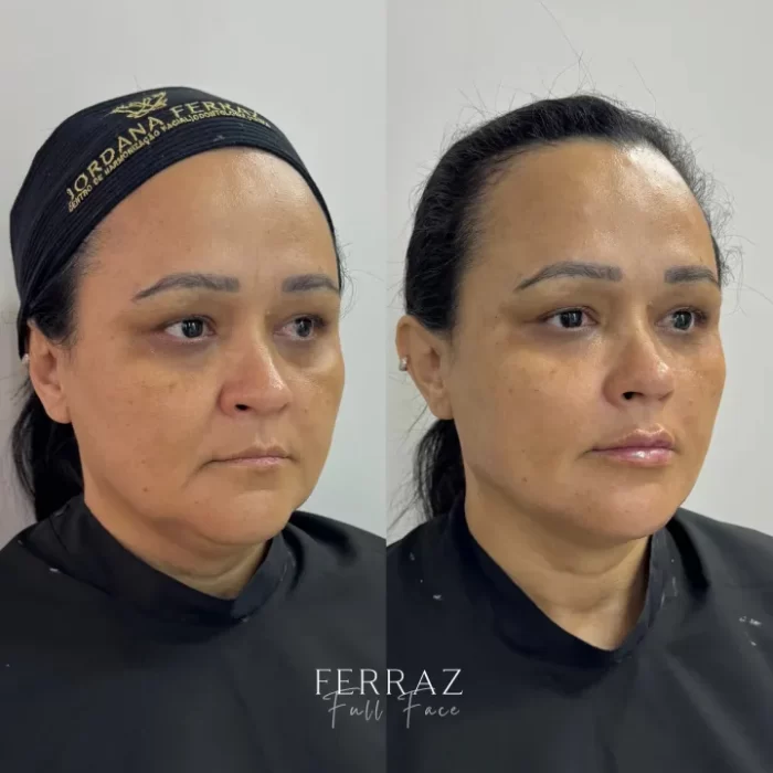 ezy_watermark_15_05_2025_08_36_34_8030