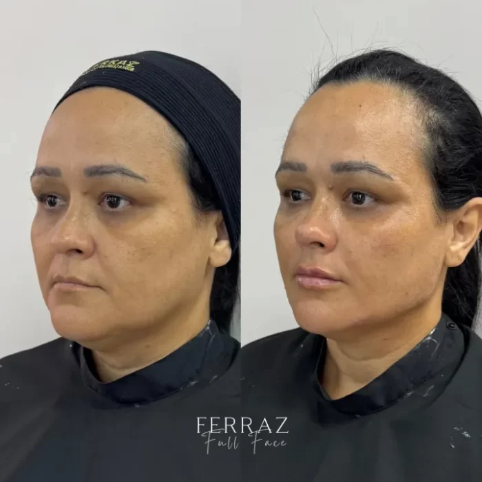 ezy_watermark_15_05_2025_08_36_35_5850