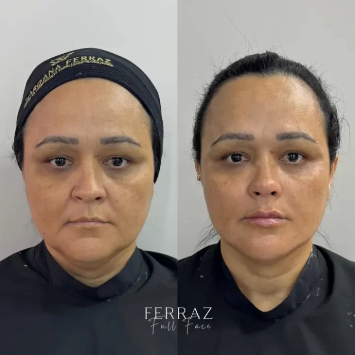 ezy_watermark_15_05_2025_08_36_35_8390