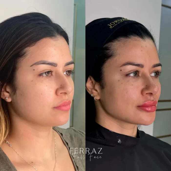 ezy_watermark_16_11_2024_12_35_21_7740