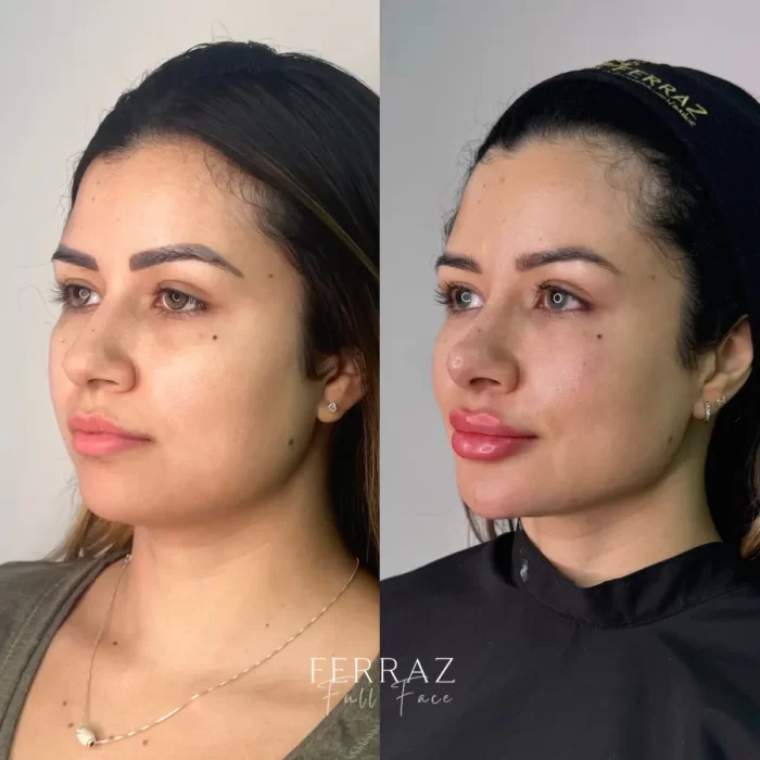 ezy_watermark_16_11_2024_12_35_22_5460