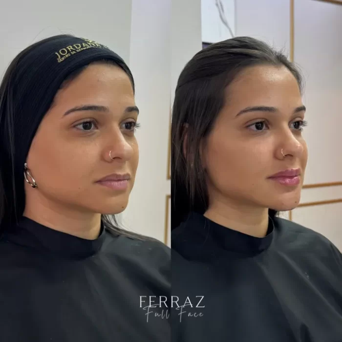 ezy_watermark_18_07_2025_16_40_18_6060