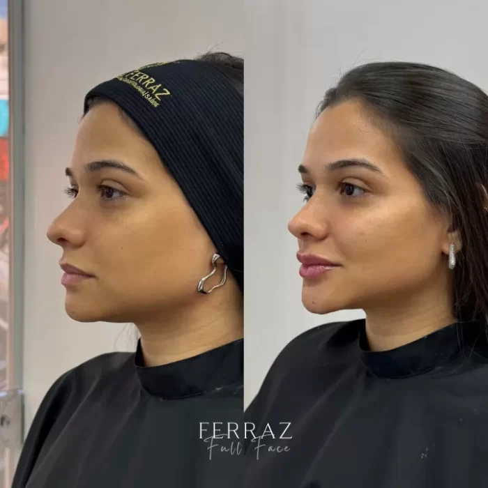 ezy_watermark_18_07_2025_16_40_18_8670