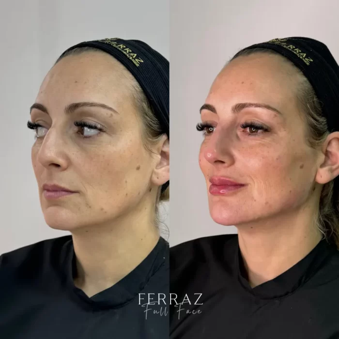 ezy_watermark_19_09_2024_16_34_26_2170