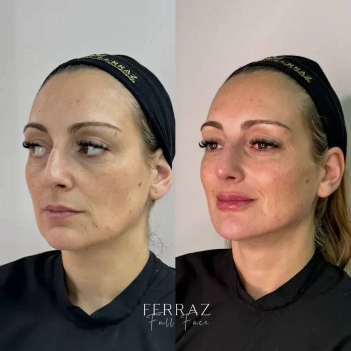 ezy_watermark_19_09_2024_16_34_28_5580