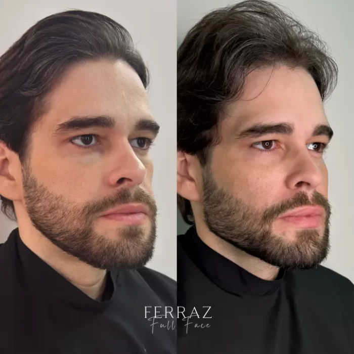 ezy_watermark_22_01_2025_21_44_01_7500