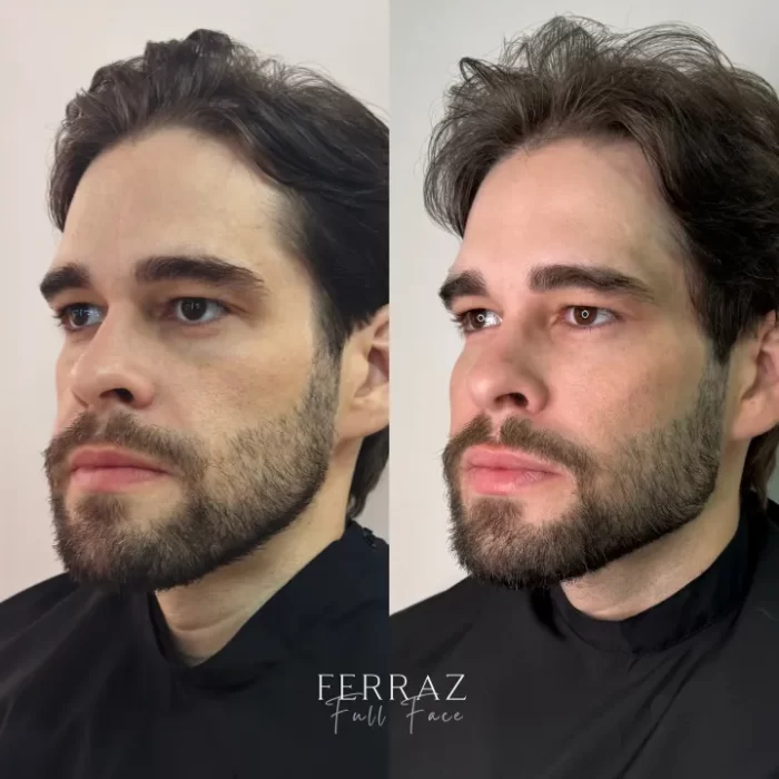 ezy_watermark_22_01_2025_21_44_02_7090