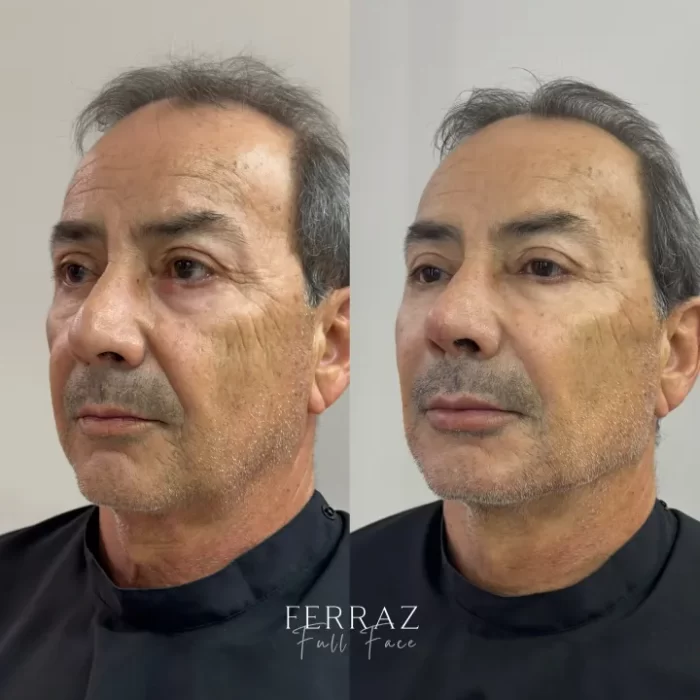 ezy_watermark_23_04_2025_14_06_11_8930