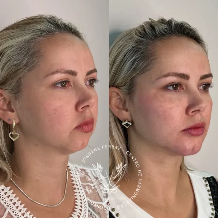 ezy_watermark_23_06_2023_12_46_14_1770