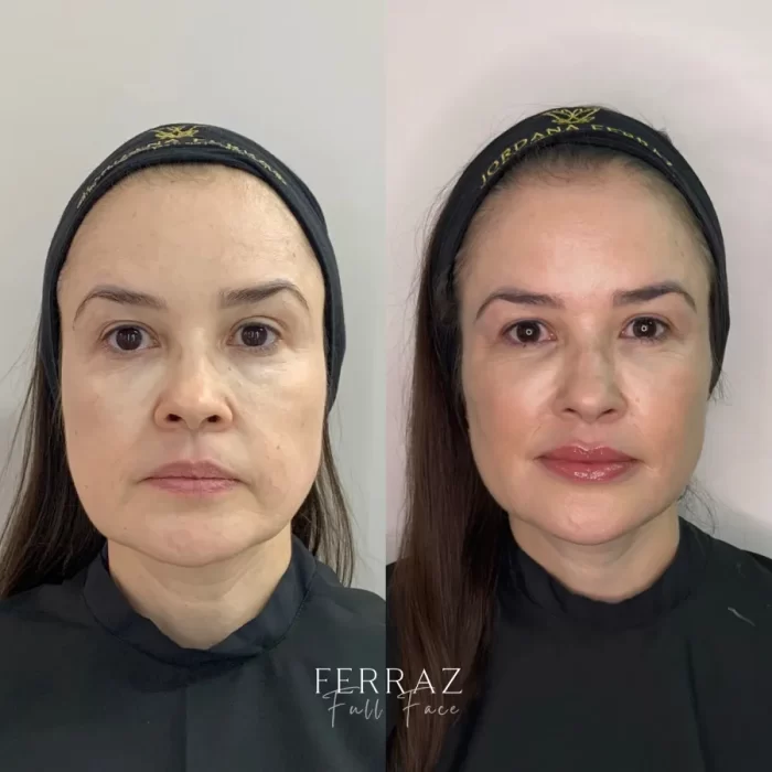 ezy_watermark_23_10_2024_17_54_35_7750