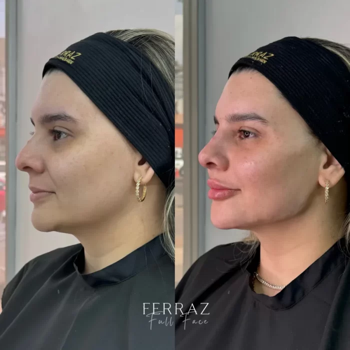 ezy_watermark_25_09_2024_12_53_59_5180