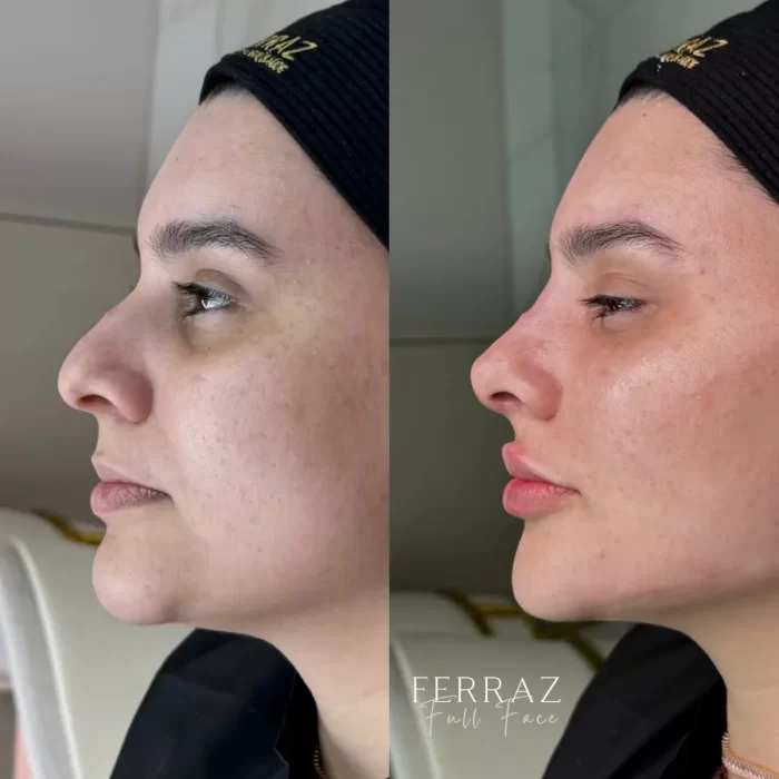 ezy_watermark_25_09_2024_12_54_02_0370