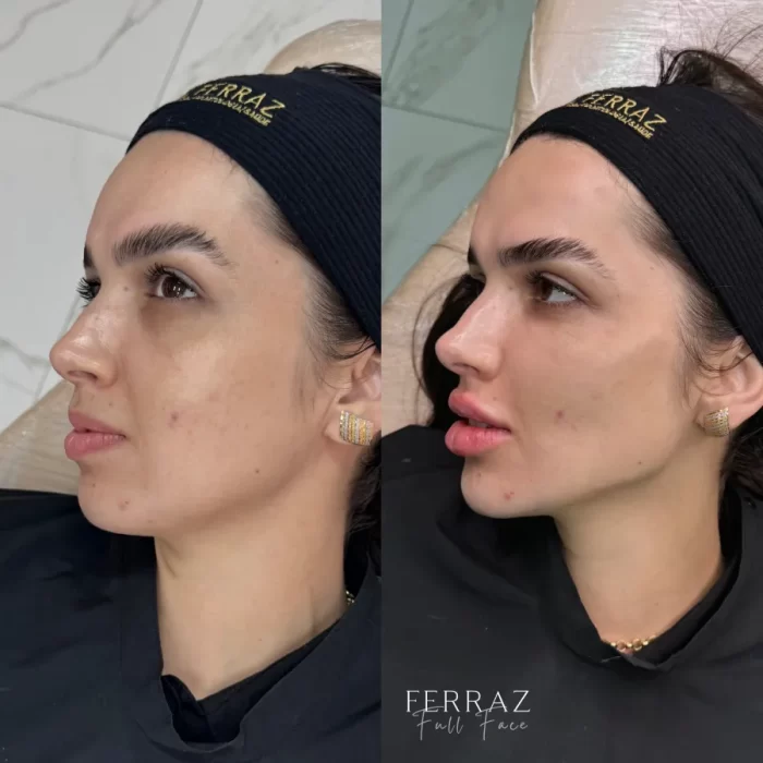 ezy_watermark_26_07_2024_15_23_04_2510