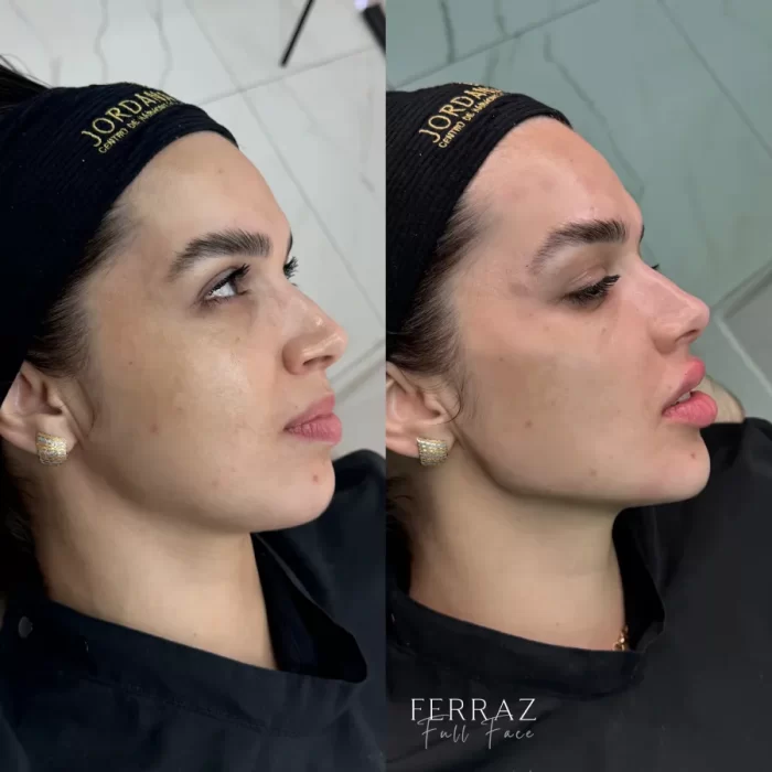 ezy_watermark_26_07_2024_15_23_04_6910